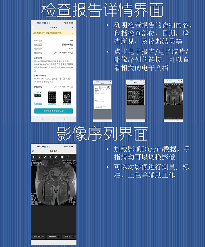 醫院放射透視檢測報告電子膠片檢查報告云管理系統軟件開(kāi)發(fā)APP小程序定制 醫院放射透視檢測報告電子膠片檢查報告云管理系統軟件開(kāi)發(fā)APP小程序定制