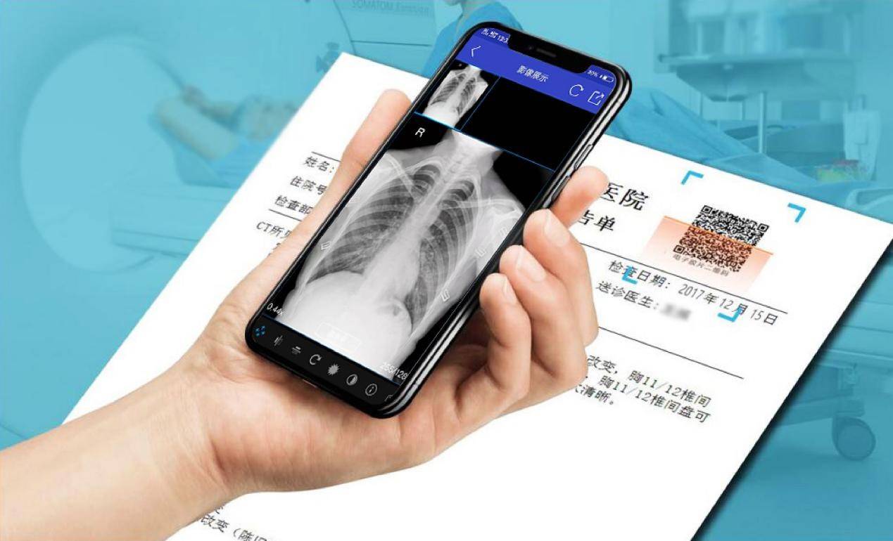 云膠片是什么？